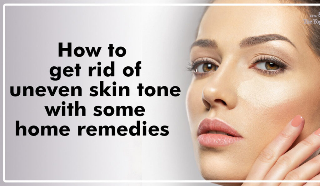 Uneven Skin Tone: Treatments, Home Remedies and Treatment Tips