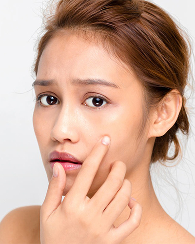 Can Mederma be used to treat acne scars?